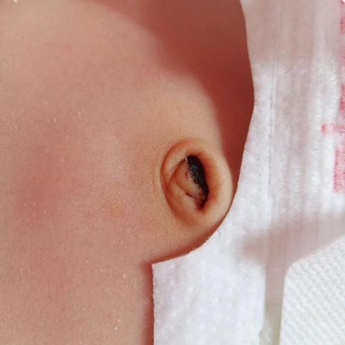 肚脐眼里的泥抠出来了有事吗为什么在线