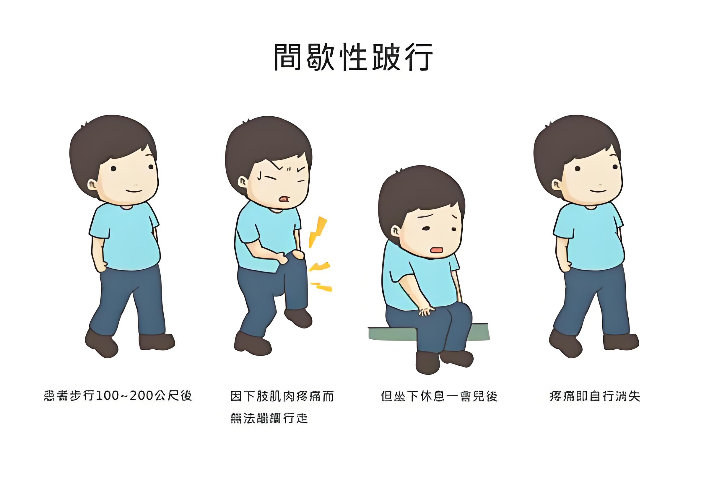 走着走着瘸了,休息休息好了?"间隙性跛行"警示:下肢动脉堵了