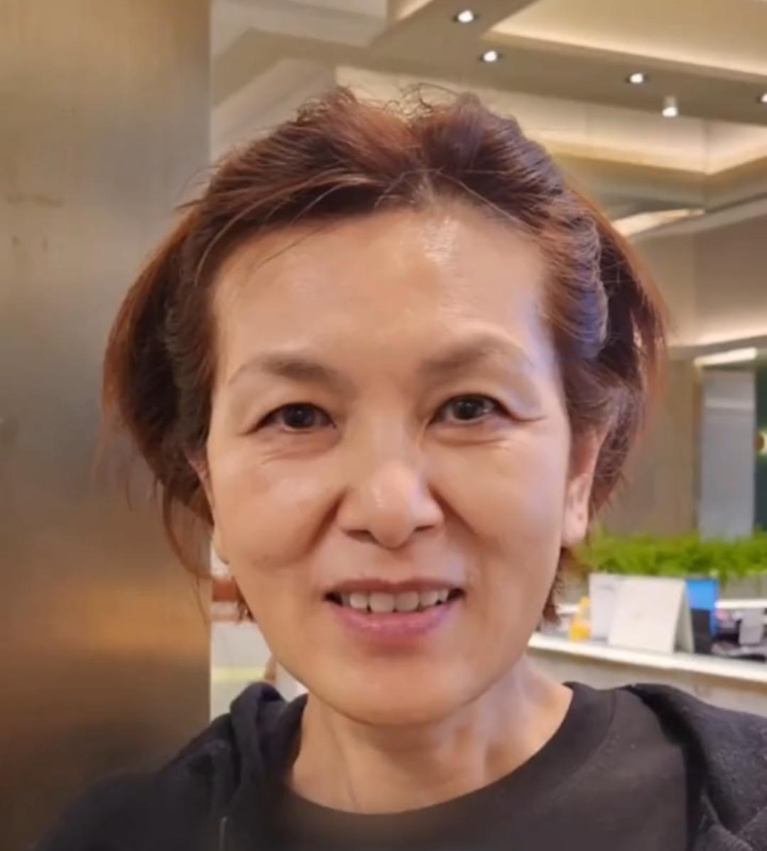 63岁退休姐姐眼周筋膜提升实录,30天前不怕疼"咬牙