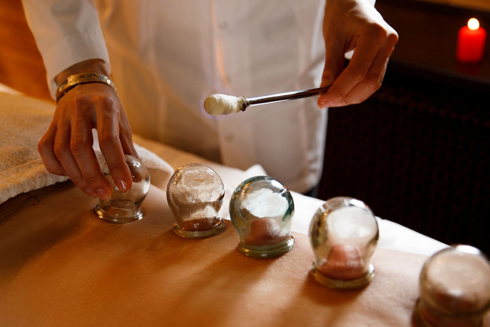 拔火罐吸出来的东西,是体内的毒素?可以看下面的讲解