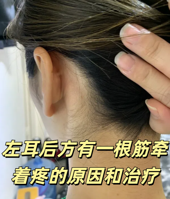左耳后方有一根筋牵着疼的原因和治疗