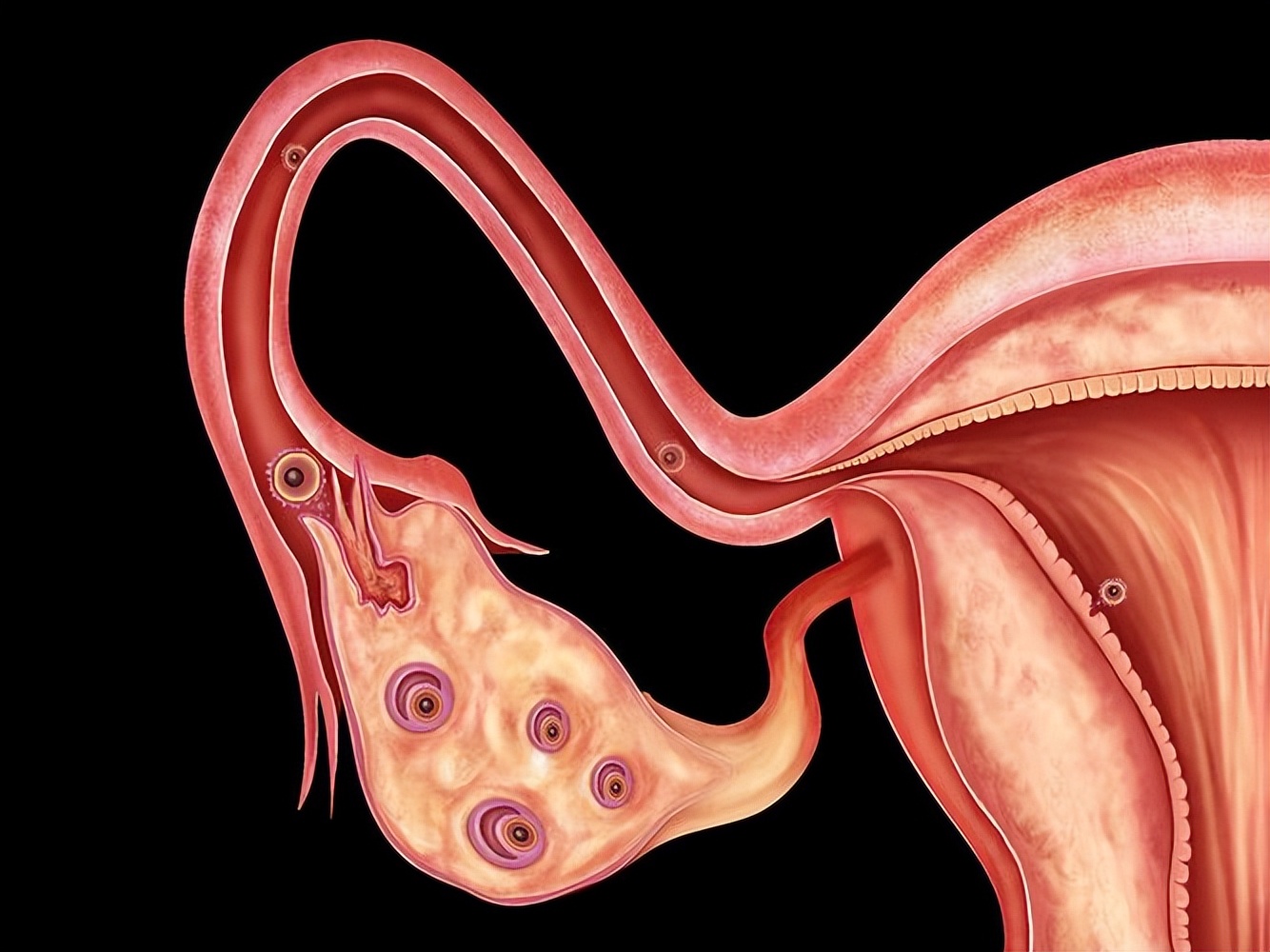 结扎会卵巢早衰?医生告诉你,它对身体的真正影响