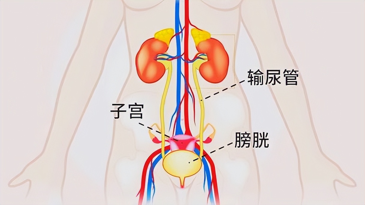 尿频,尿急,憋不住尿是卵巢癌吗?医生一文讲清楚