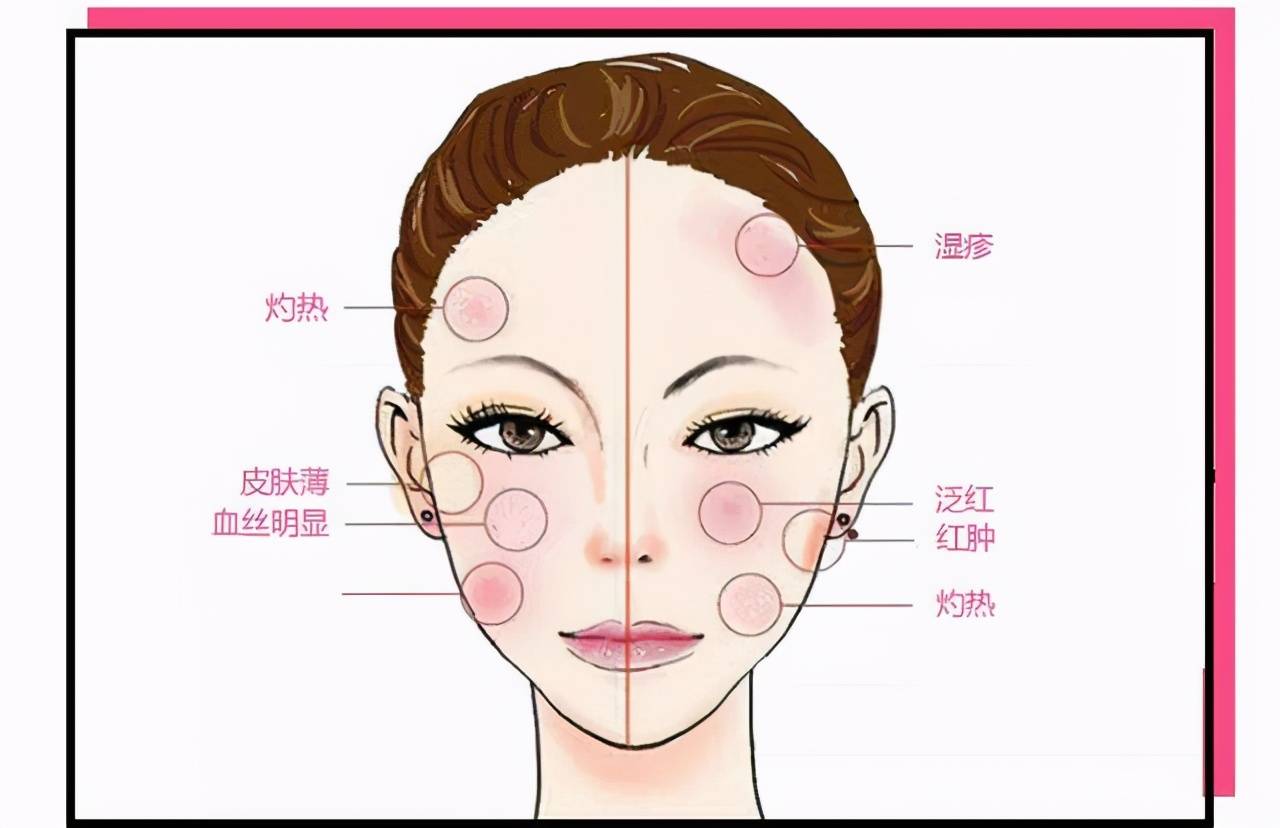 皮肤泛红、刺痛是什么原因导致?