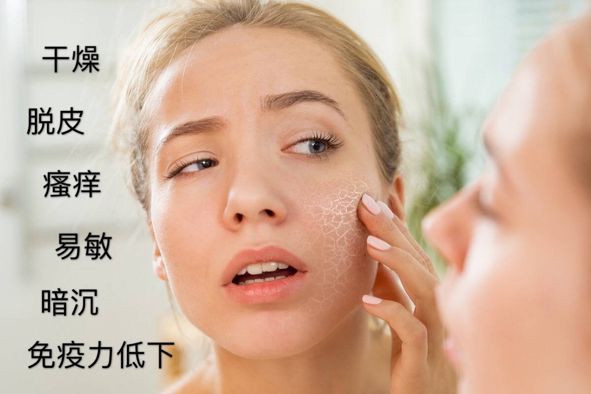 敏感肌护肤品如何选择?