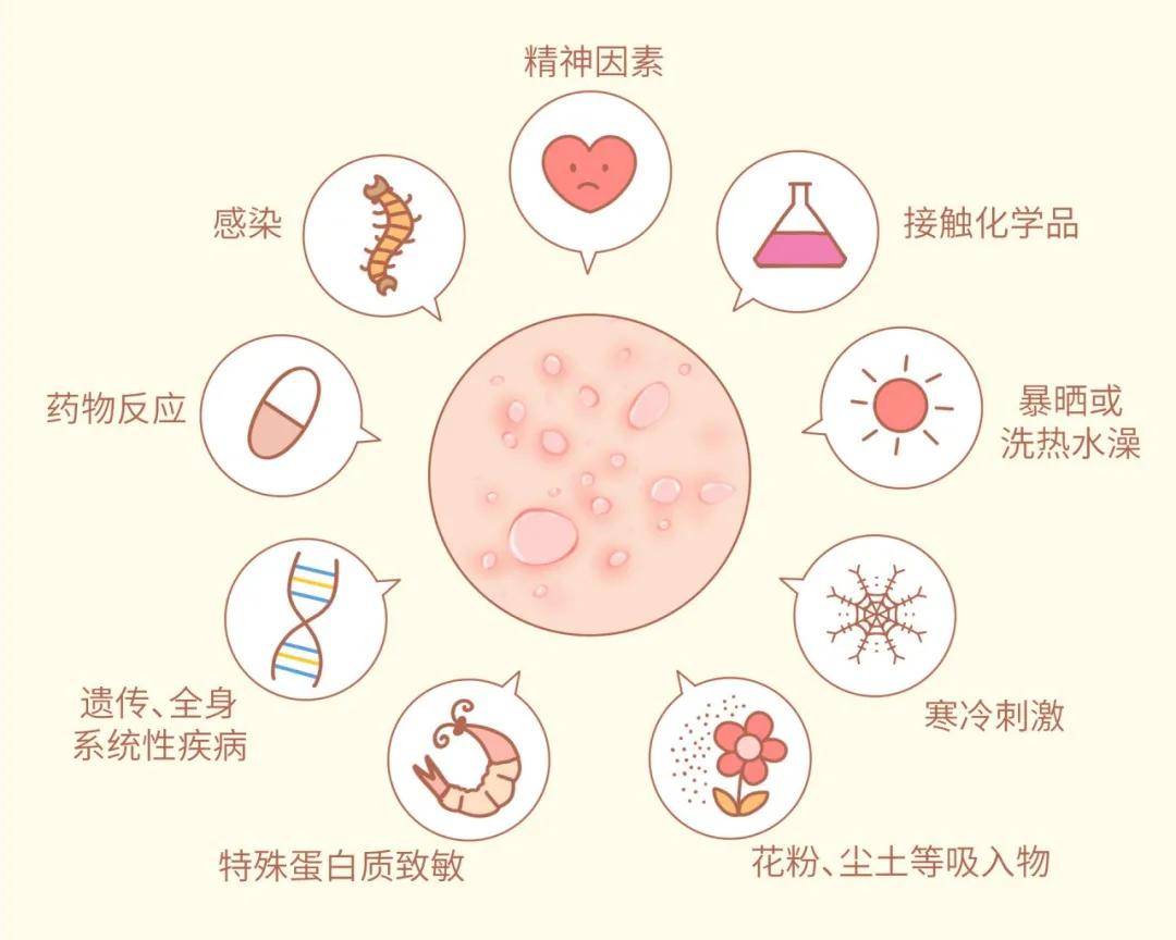 湿疹反复发作,生活中如何注意?