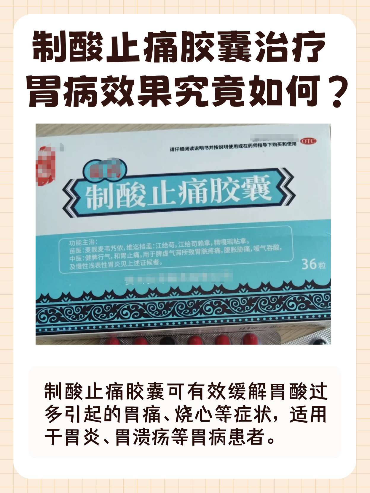 制酸止痛胶囊对于治疗胃病有着一定的功效