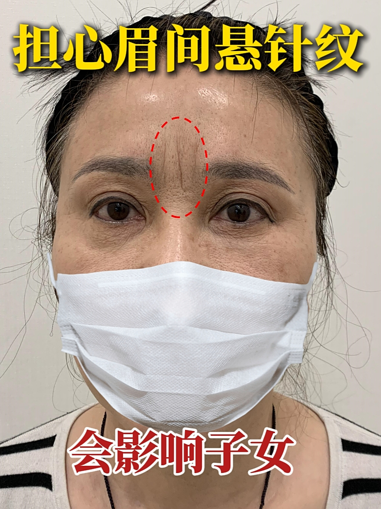 虽然有点迷信,但我依然很苦恼