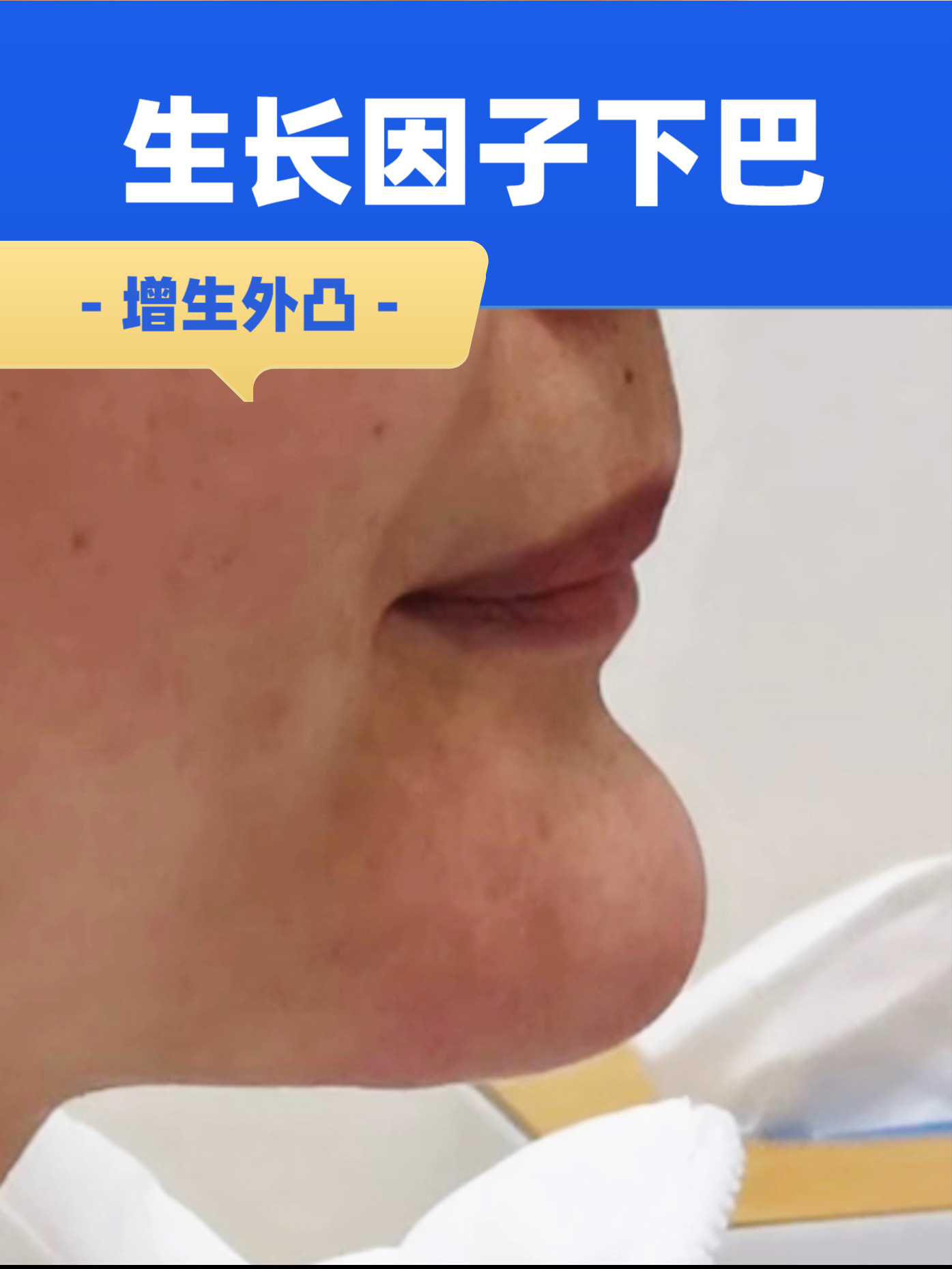 找劉文閣面診的注意事項(xiàng)，避免白跑