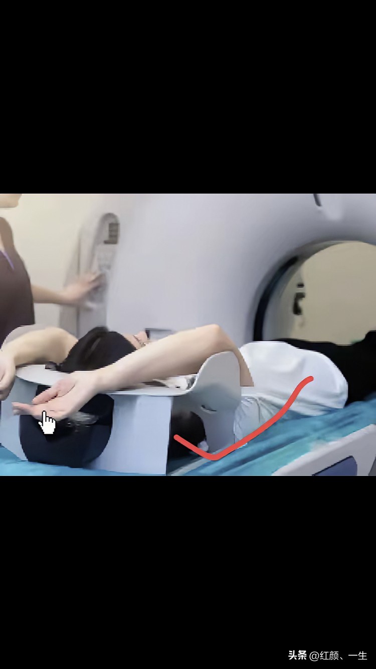 青少年,年轻人也不能掉以轻心,中老年人频繁检查同样ct摆放体位肺部ct