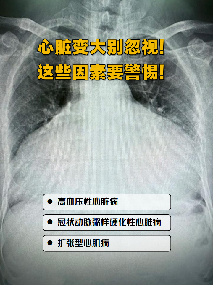 心脏为什么会肥大