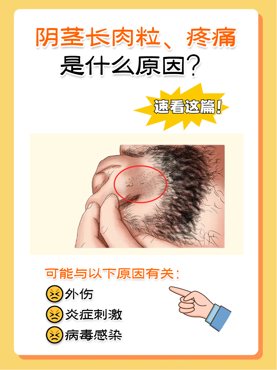 阴茎长肉粒,疼痛,可能与以下原因有关: 外伤