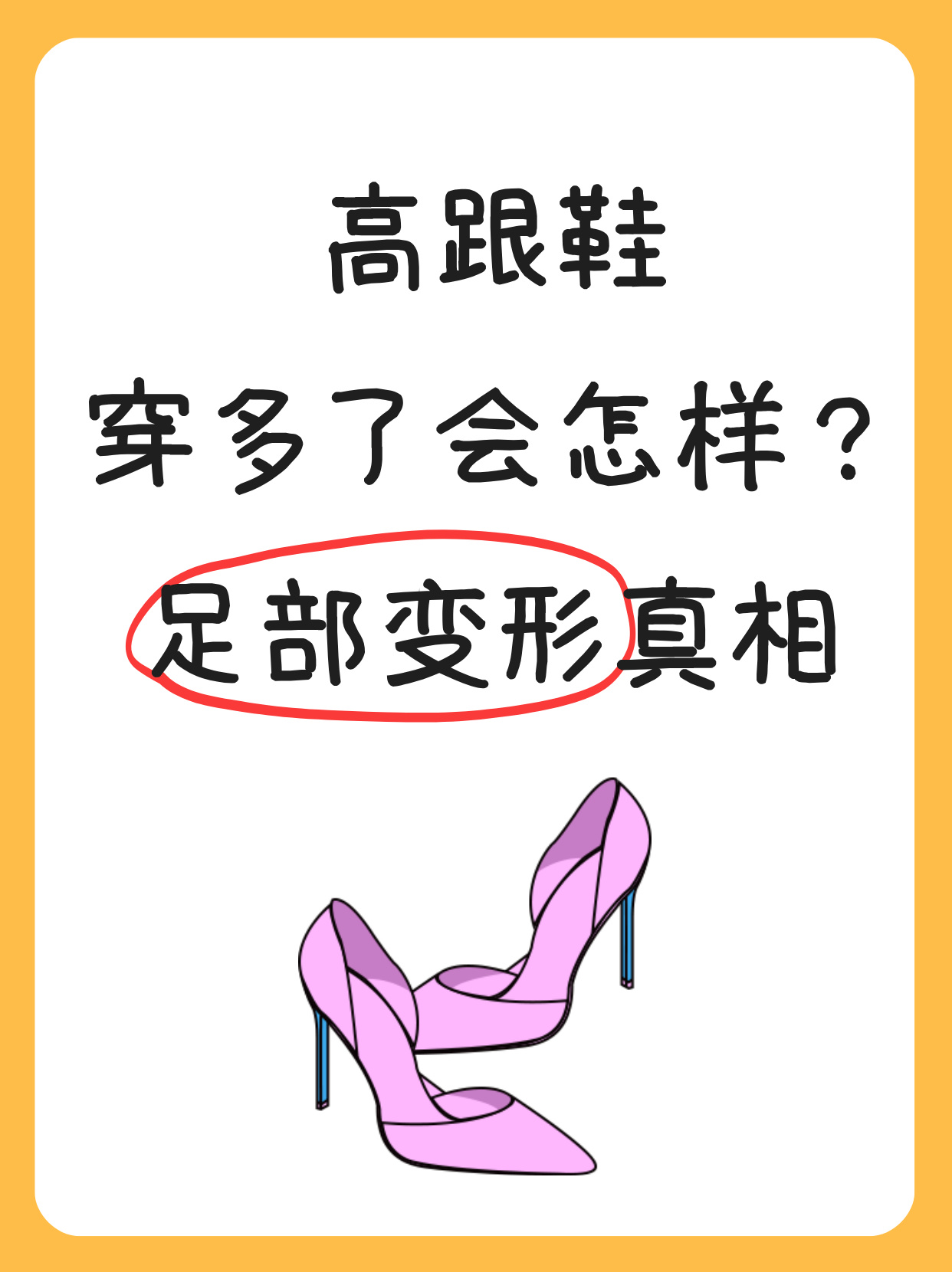 改变足底的压力分布增加前脚掌和脚趾的压力长期穿着可能导致跖骨痛