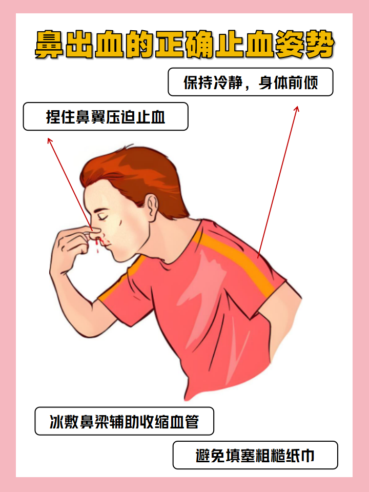流鼻血时正确的止血方法是如何正确止住鼻血鼻出血正确处理方法图片