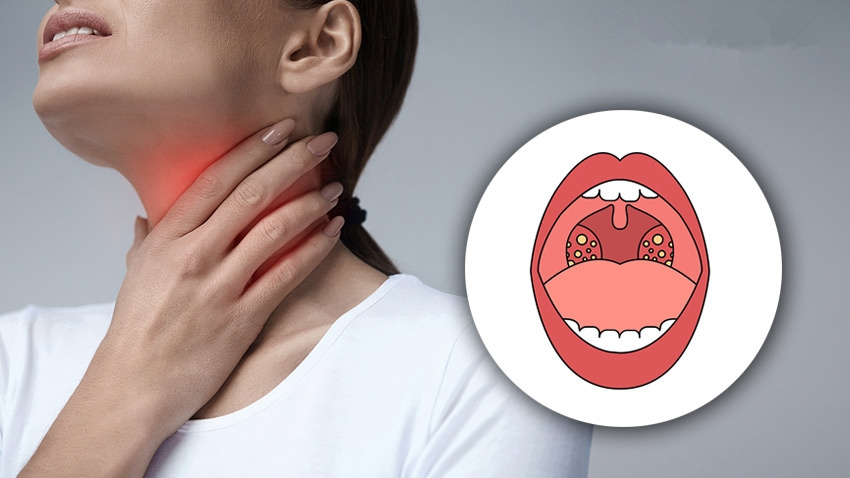 疏肝化痰竟有比逍遥丸,二陈丸更妙的中成药?用对者都夸好?