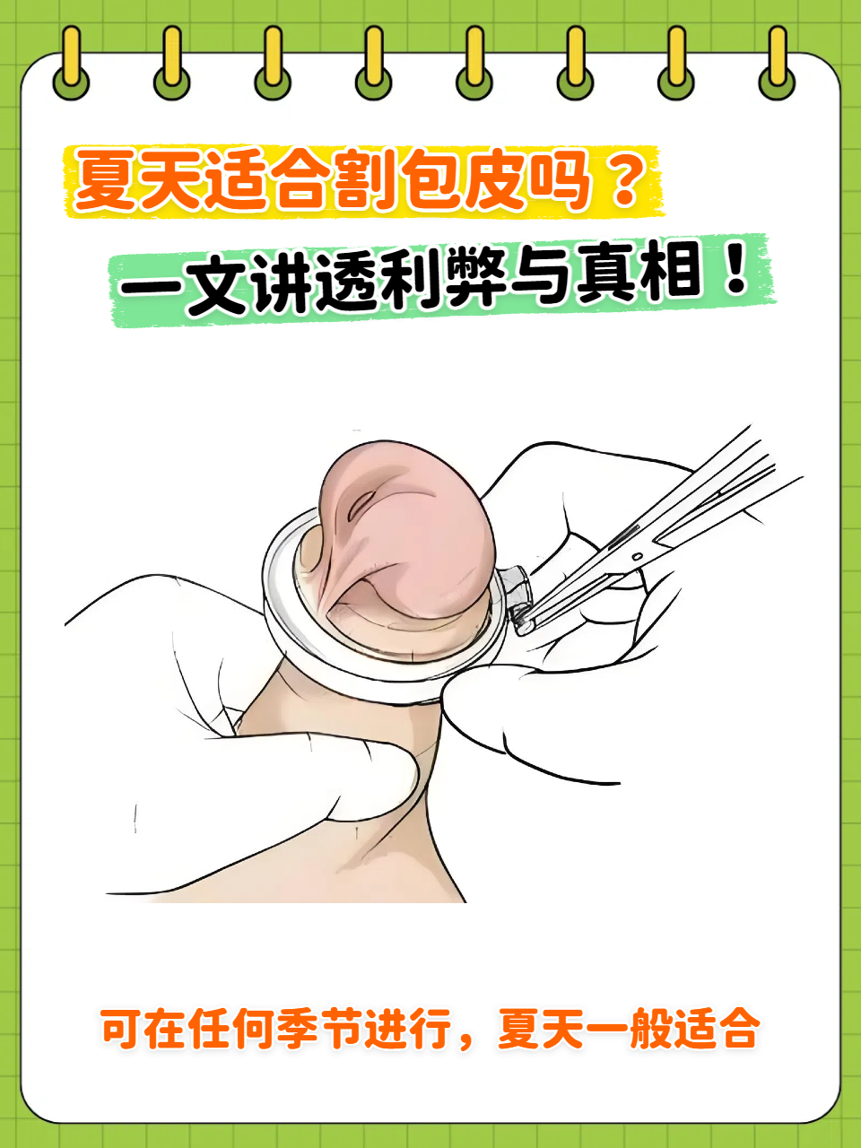 夏天是否适合割包皮: 夏天一般矢畎ぐ 手术割包皮真实自翻和割