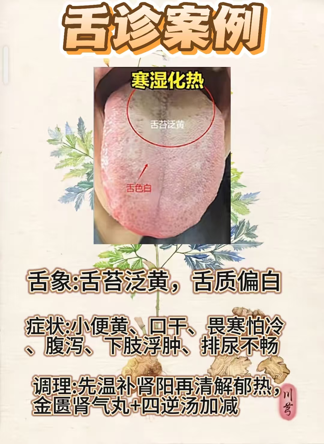 为什么舌苔发黄