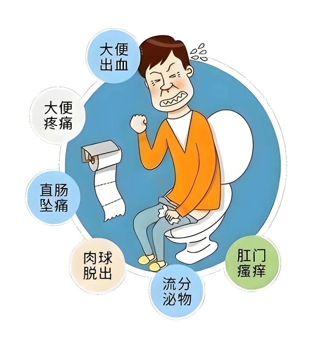 科普|为什么痔疮突然变硬变疼?你可能得了血栓性外痔!