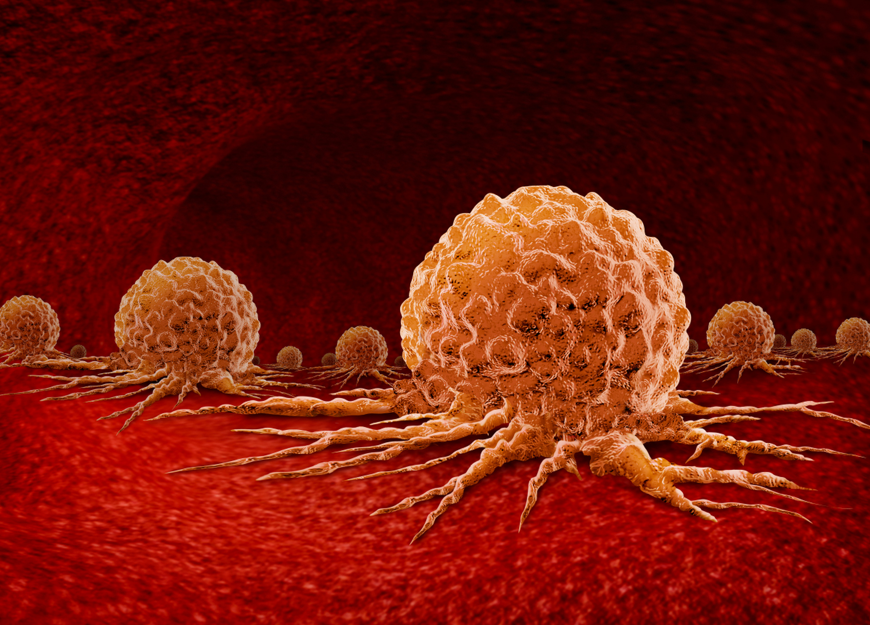 子宫肌瘤为何会发生变化?上海一女子引发思考:2个习惯需注意?