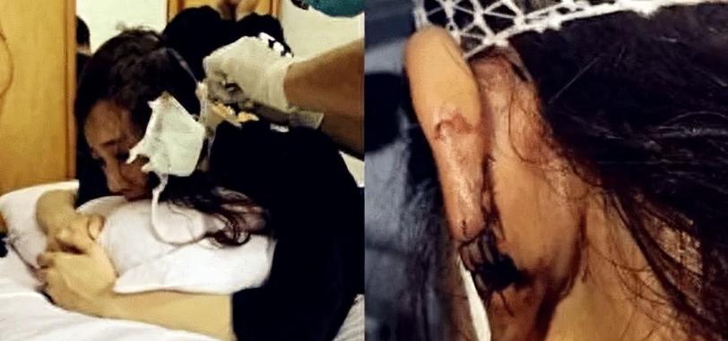 回顾李依晓:古装第一美人被狗咬毁容后,如今41岁靠演坏女人翻身