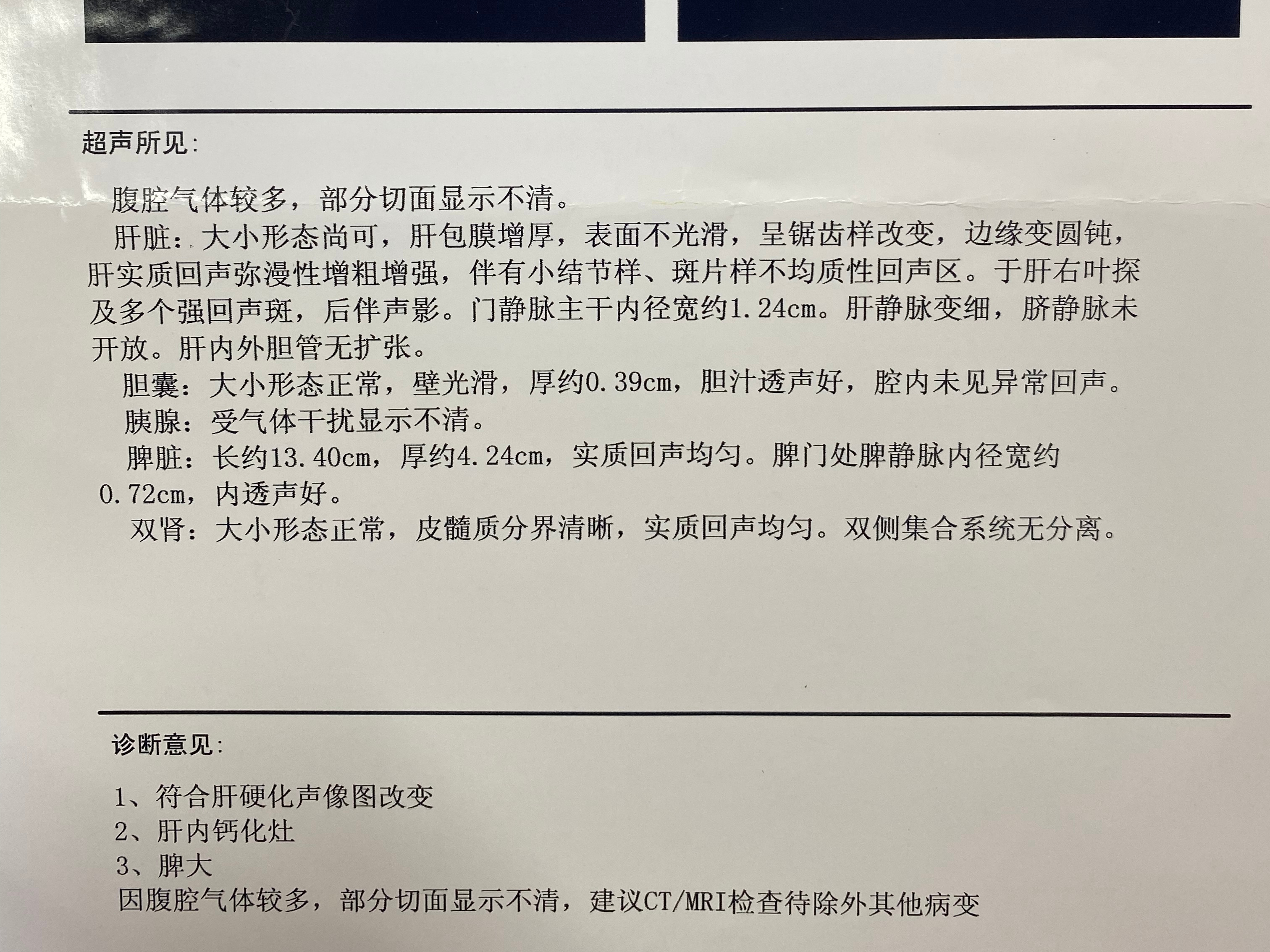 肝硬化逆转,关键看2个指标! 第一个指标是 肝硬度值!