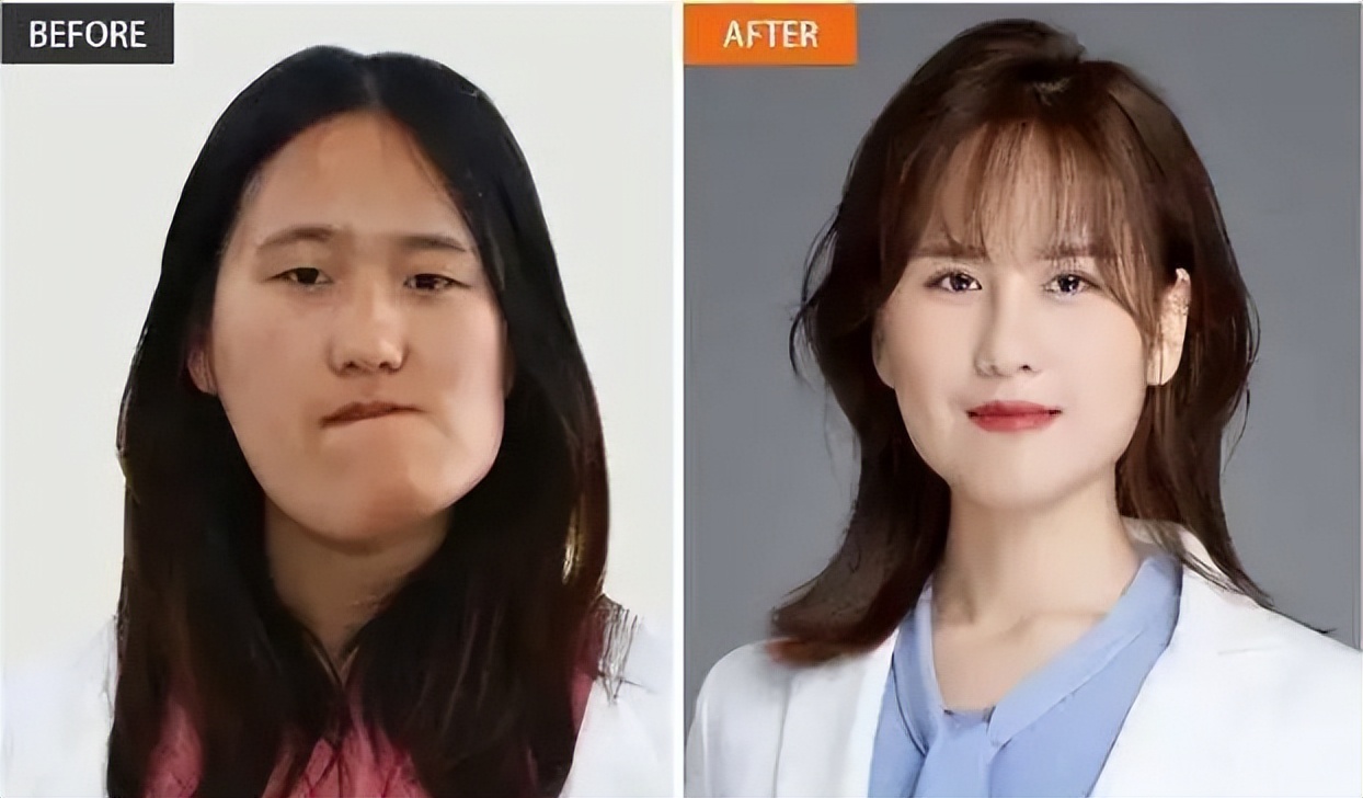 回顾辽宁歪脸女孩,父母双亡,她整容变美女,拒百万年薪,只想当老师