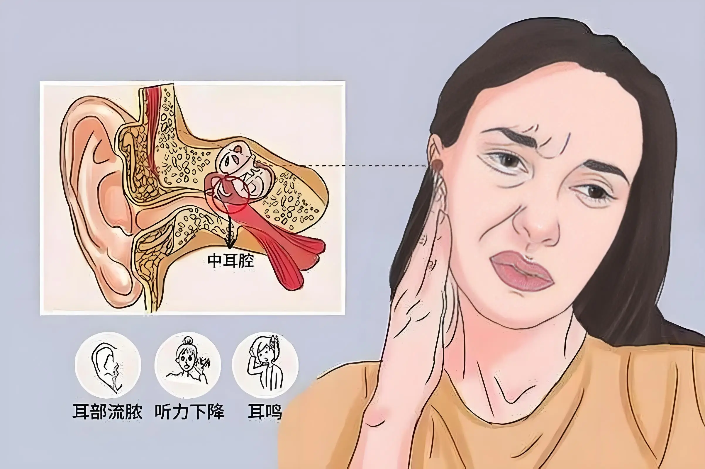 概念,中医讲的"耳鸣",跟西医讲的"神经性耳鸣""感音性耳鸣"有相似之处