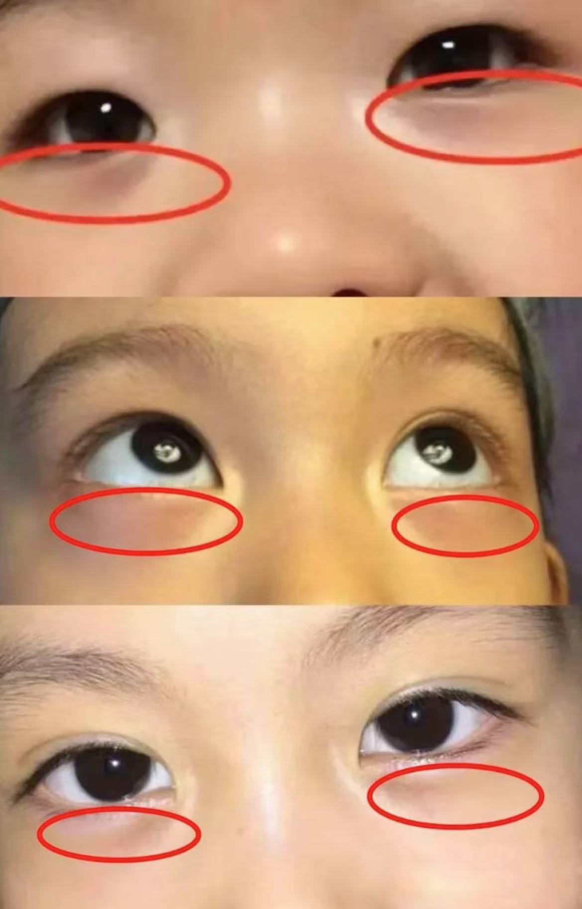 孩子脸上出现这4种信号,说明孩子脾胃弱,不容易长高