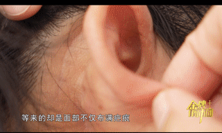 女子美容手术竟变毁容噩梦:宣传天花乱坠 事后却人去楼空?(图6)
