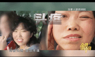 女子美容手术竟变毁容噩梦:宣传天花乱坠 事后却人去楼空?(图7)