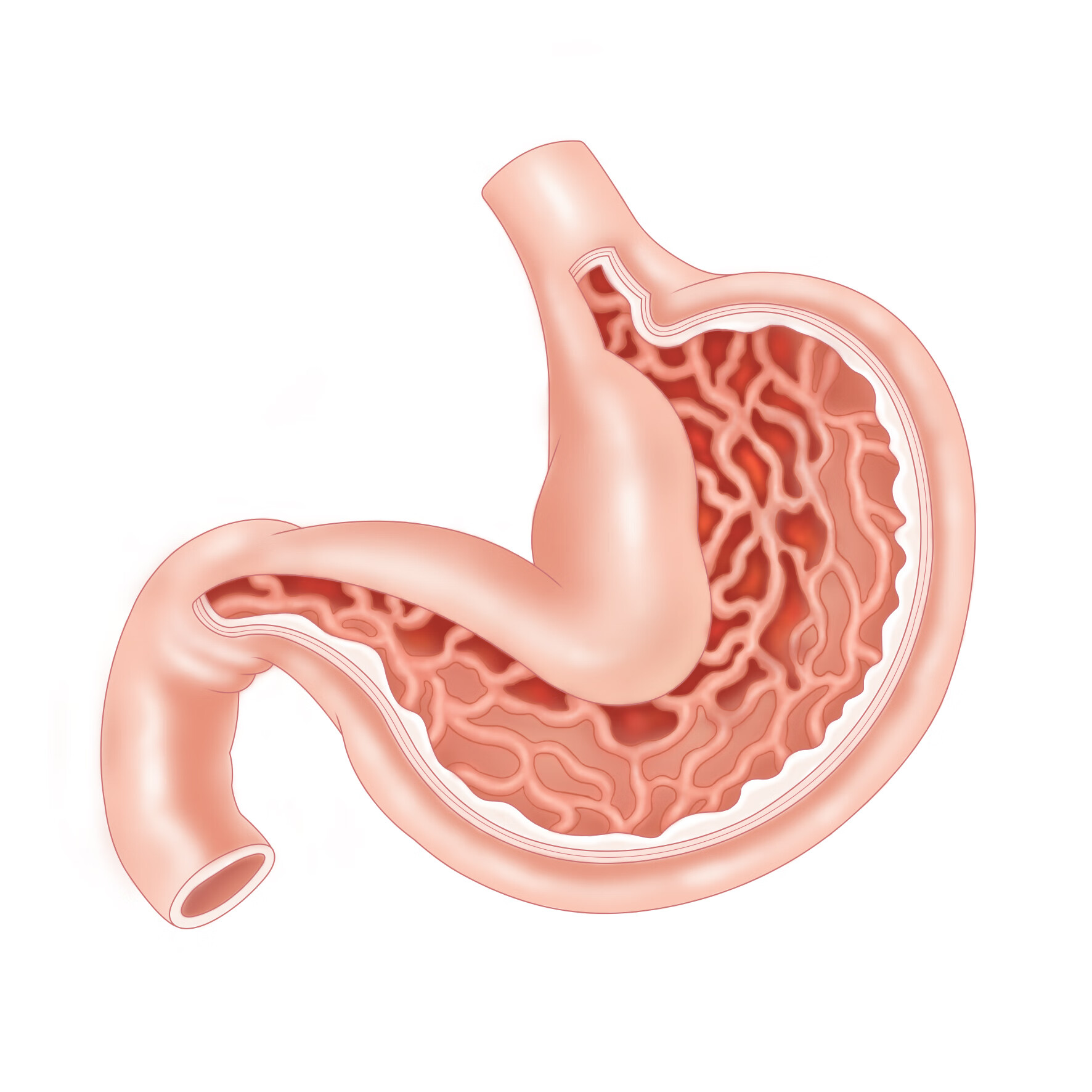 "肚子痛"到去世,仅48小时!突如其来的悲剧,忽视的健康警钟!