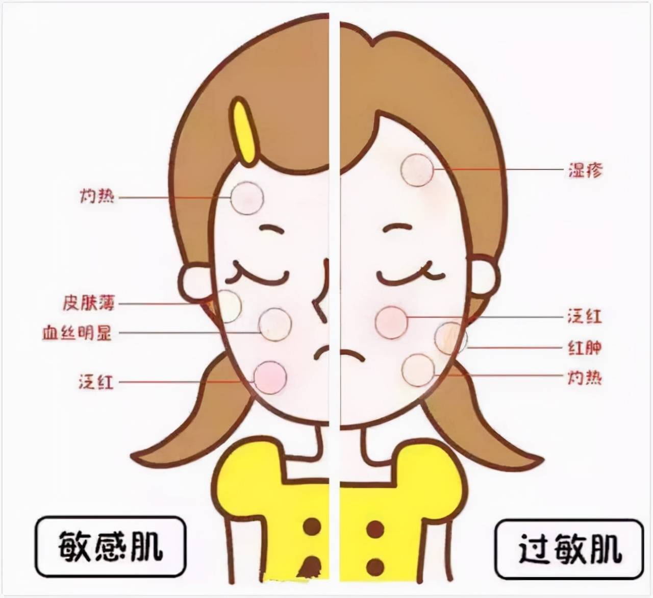 做好防晒,能够预防哪些皮肤问题?