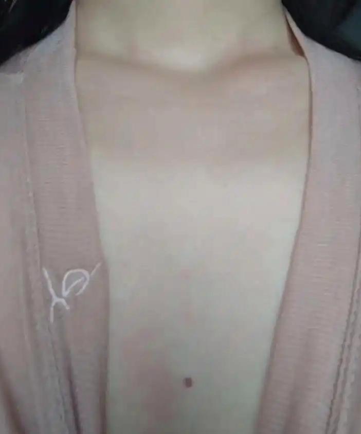 从佛学角度看痣相:为何胸口痣被认为具有特殊命运启示?