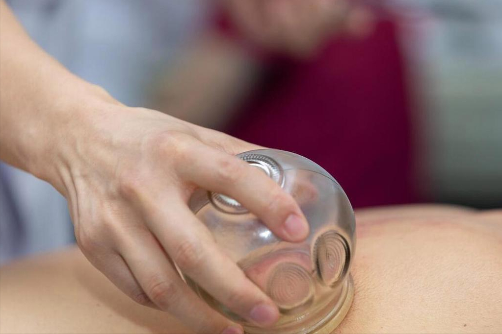 脖子拔罐黑紫色正常吗?中医告诉你拔罐原理,驱散你心中的疑虑