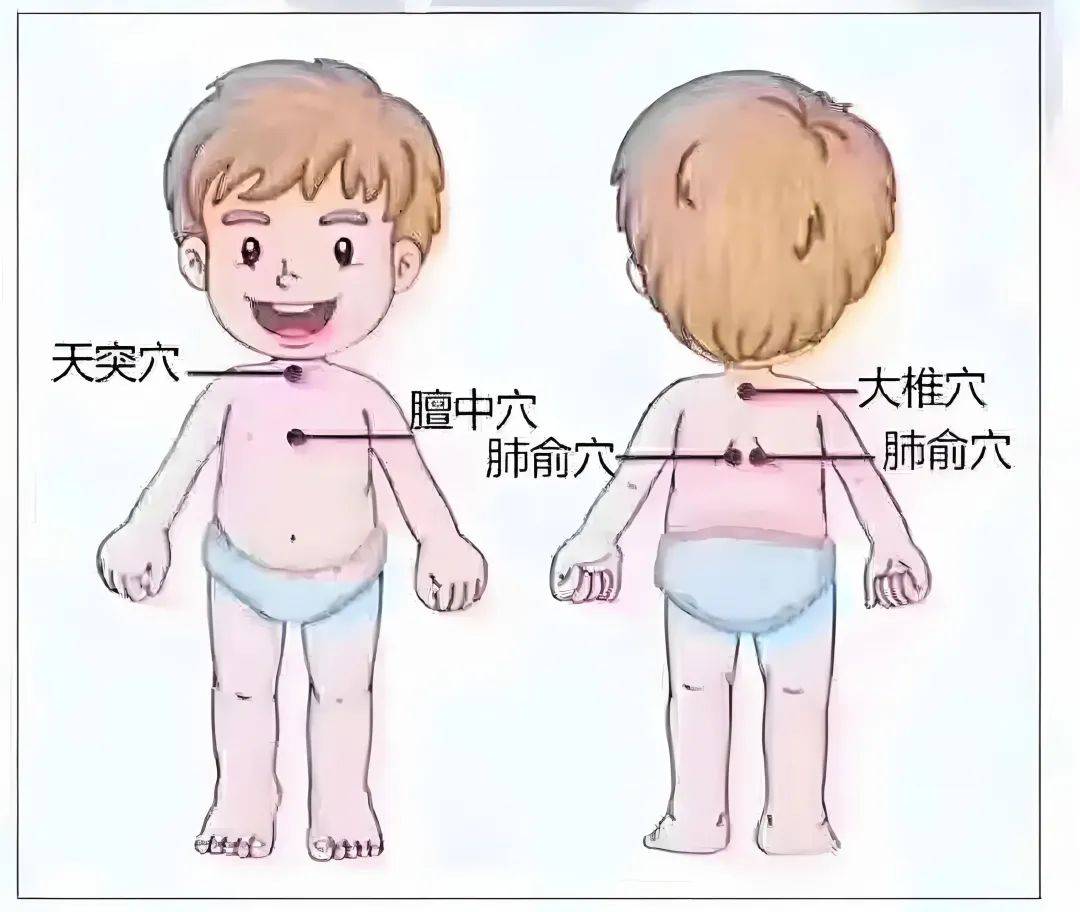 这个夏天别错过!三伏贴预约通道开放,传统疗法护儿康