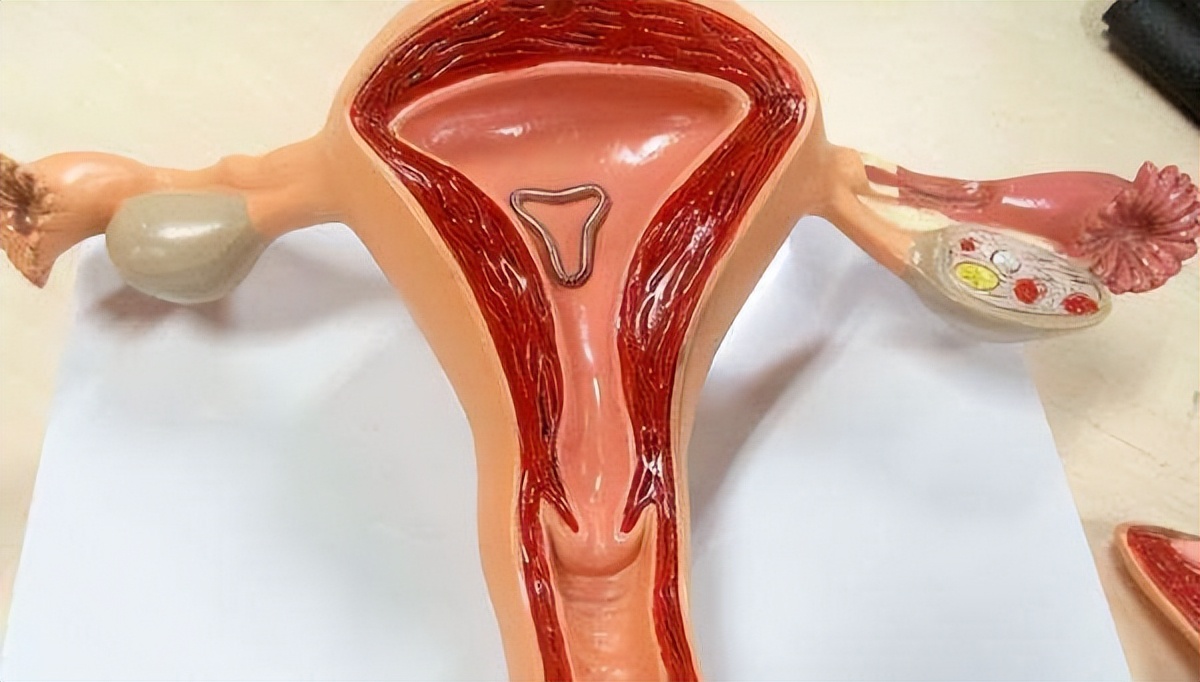 女性上环的全过程,看完心疼了!男女都要好好看看,珍惜眼前人