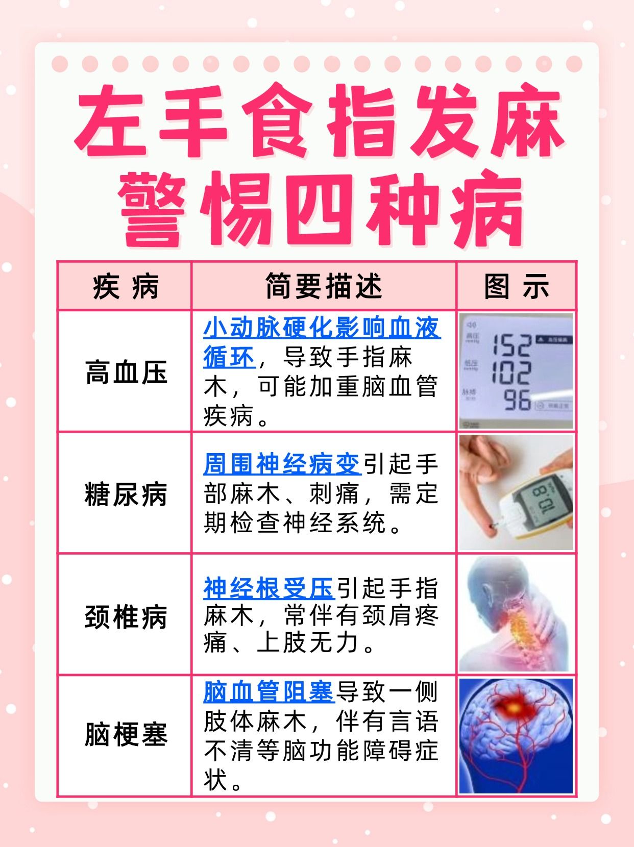 为什么左手会发麻