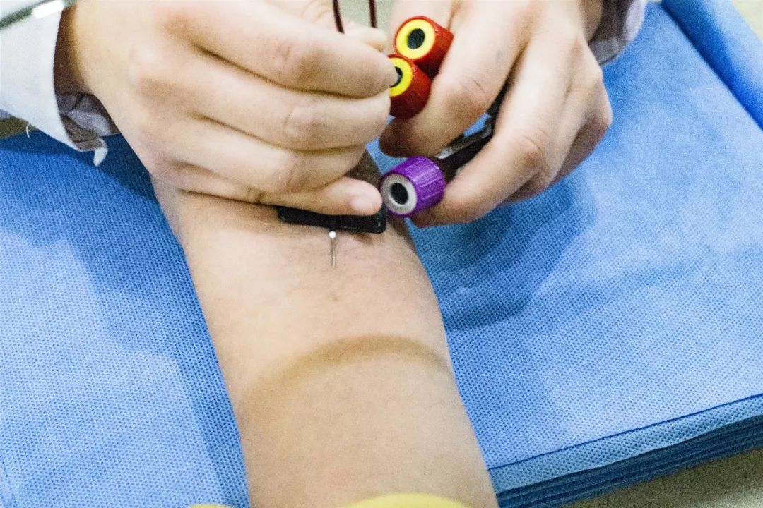 体检报告上出现这异常,建议到医院进一步检查,排除大病的可能!