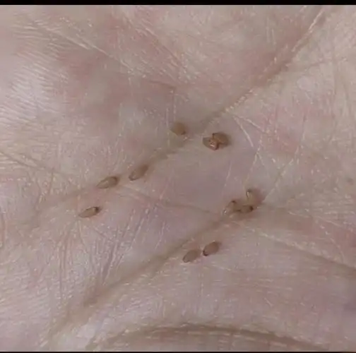 猫绦虫节片会在人身上存活吗?3 个感染风险要警惕