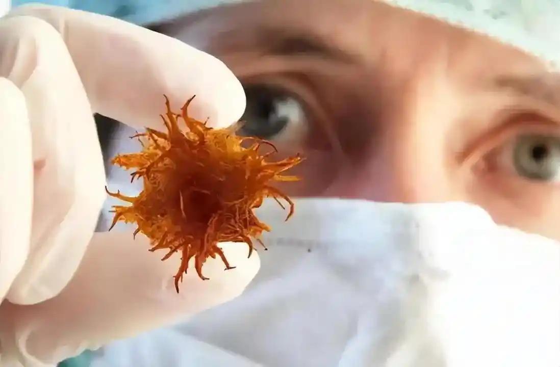 靶向药治疗前为何要做8000元基因检测？医生解释原因很现实