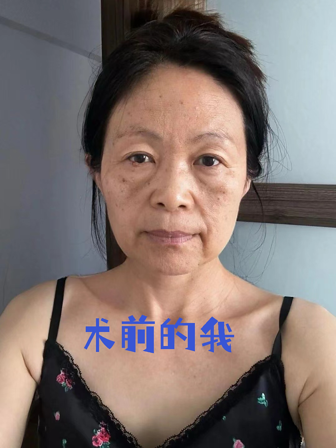 这就是我,每天因为爱看剧,天天熬夜看短剧,脸