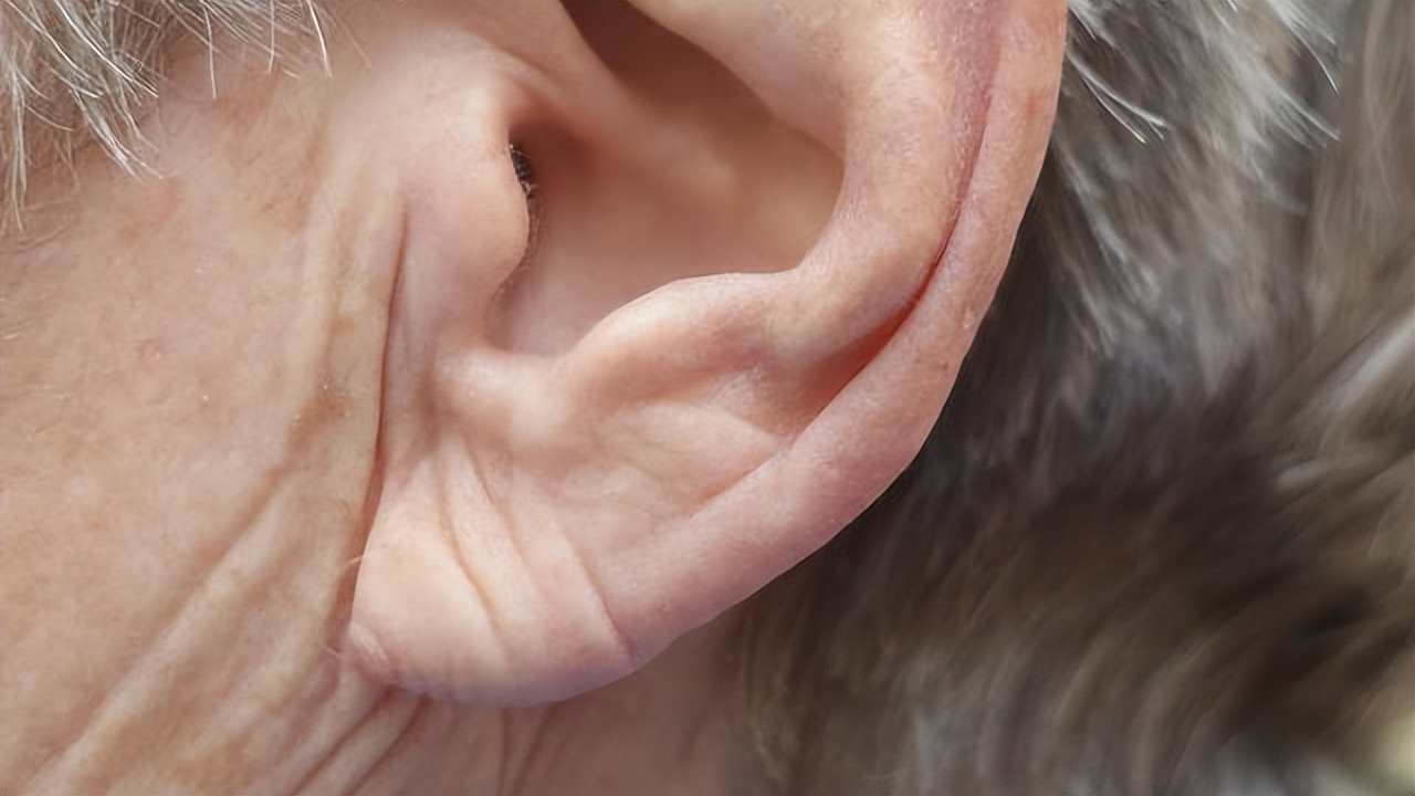 耳朵上有这条折痕,是心梗,猝死的"标志"?医生:警惕这些异常