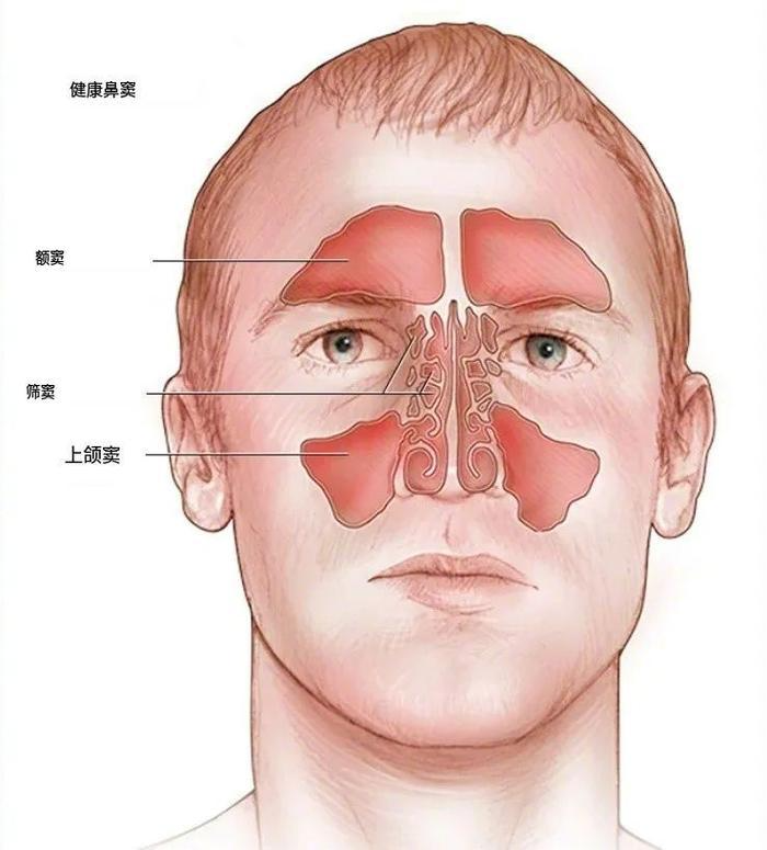 上颌窦在脸颊处,筛窦在两眼内侧,额窦在额头,蝶窦在脑袋深处