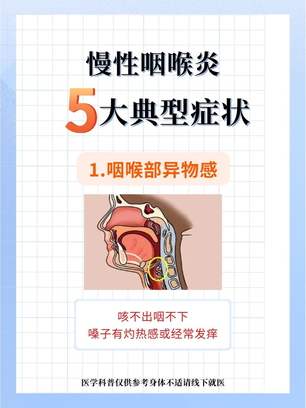 为什么阳康后喉咙不舒服