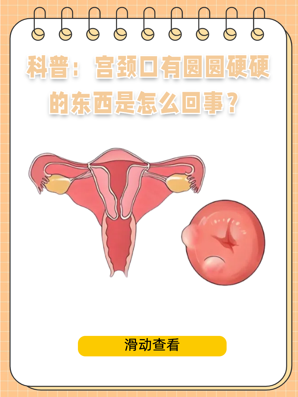 宫口有肉疙瘩,可能是宫颈息肉,它和炎症刺激,内分泌紊乱有关