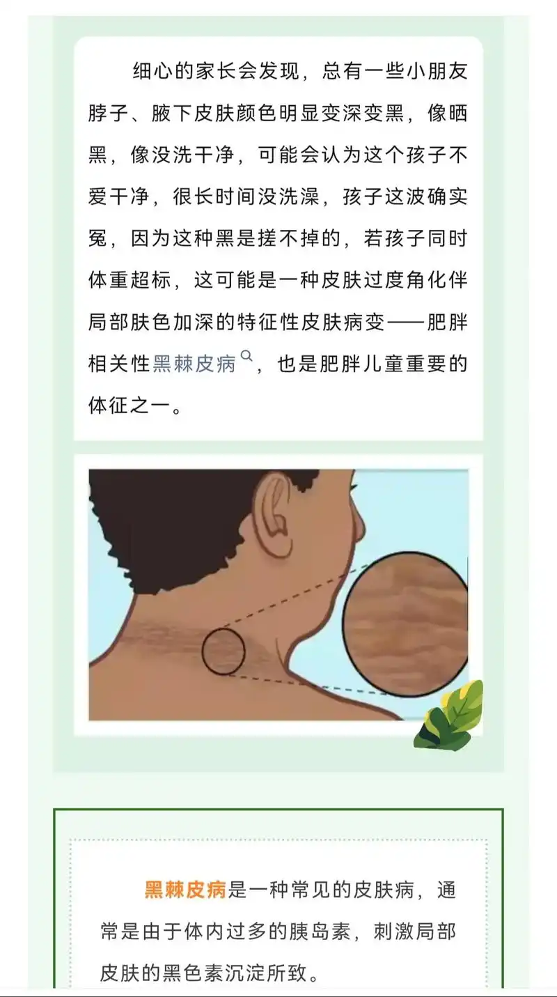 12岁孩子脖子黑不一定是糖尿病