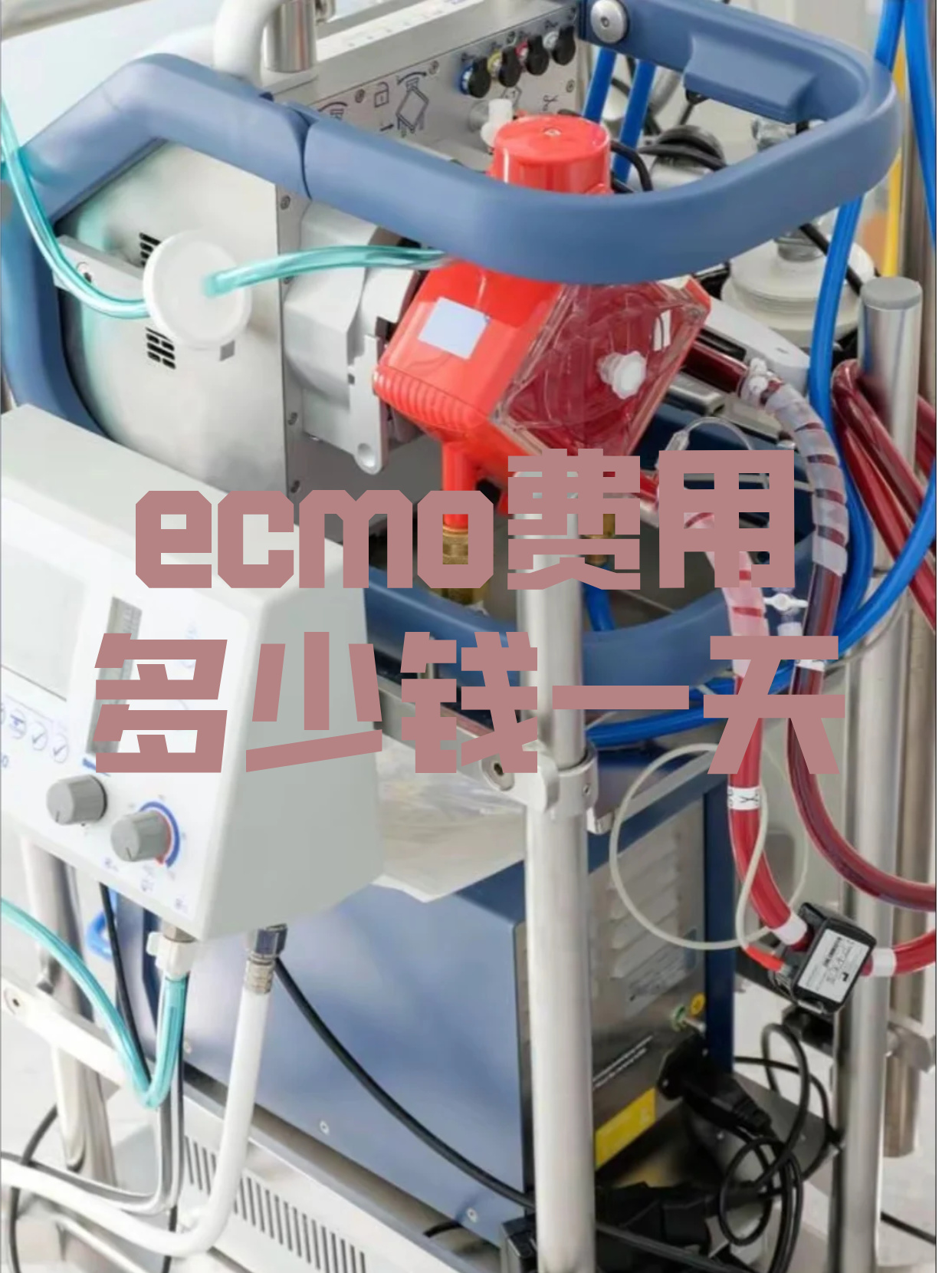 ecmo一天的费用通常在1万到3万元左右