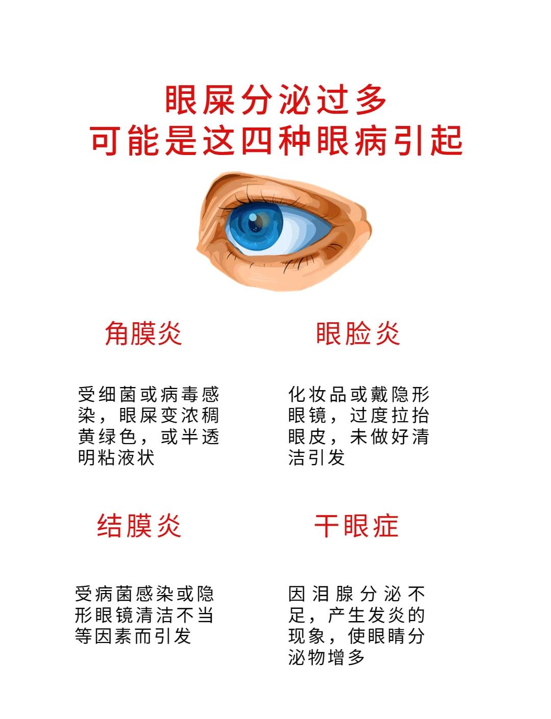 眼睛模糊眼屎多,可能是上火或用眼过度,也可能是眼部有炎症