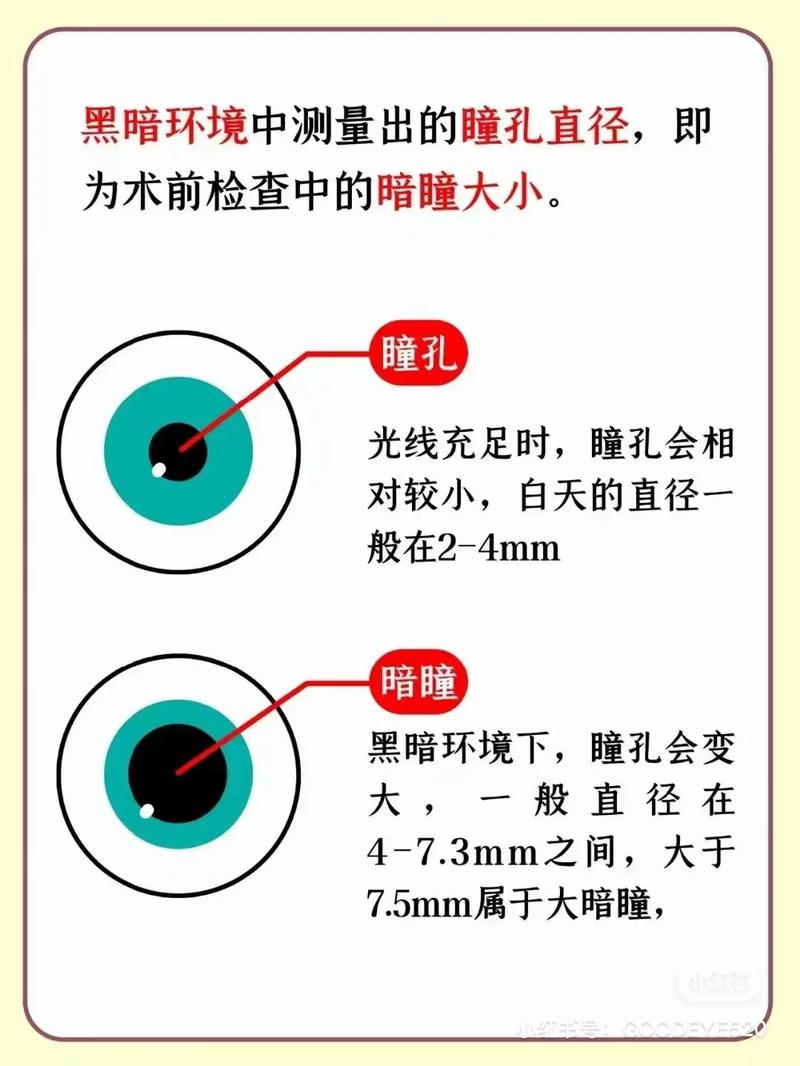 正常情况下,瞳孔直径在2