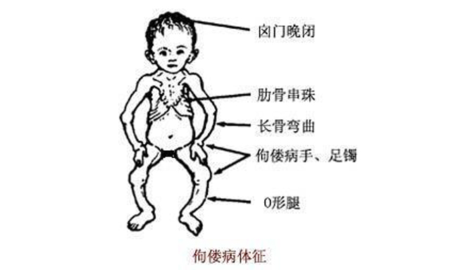 16年,女孩长期吃维生素d,防止佝偻病,坚持半年后情况怎样了?
